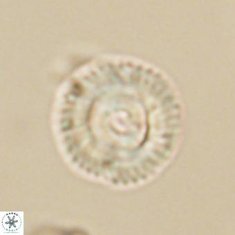 Coccolithus gracejacovidesiae 68482