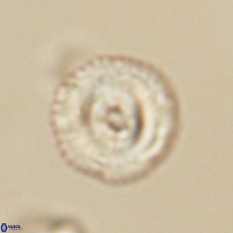 Coccolithus gracejacovidesiae 68483