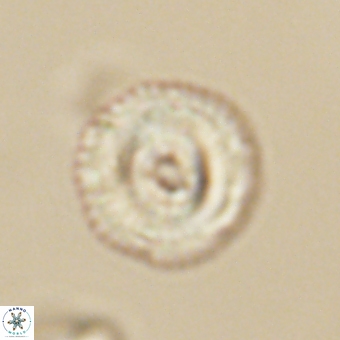 Coccolithus gracejacovidesiae 68483