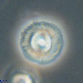 Coccolithus gracejacovidesiae 68486