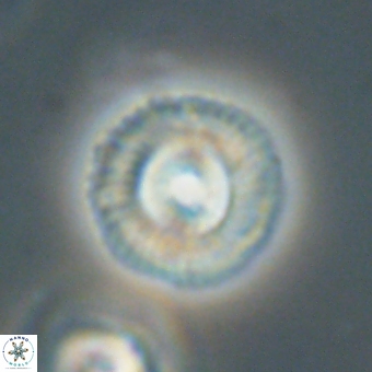 Coccolithus gracejacovidesiae 68486