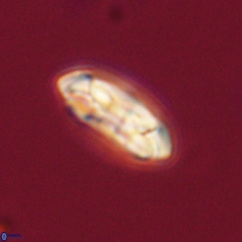 Coccolithus gracejacovidesiae 68491