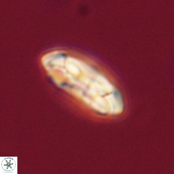 Coccolithus gracejacovidesiae 68491