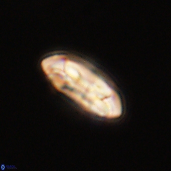 Coccolithus gracejacovidesiae 68492