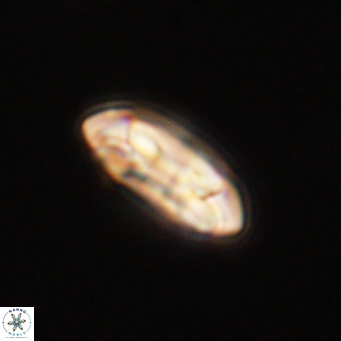 Coccolithus gracejacovidesiae 68492