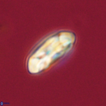 Coccolithus gracejacovidesiae 68495