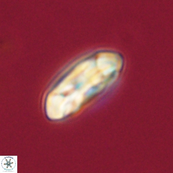Coccolithus gracejacovidesiae 68495