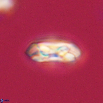 Coccolithus gracejacovidesiae 68502