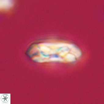 Coccolithus gracejacovidesiae 68502