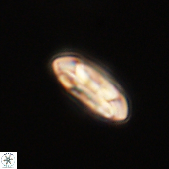 Coccolithus gracejacovidesiae 68505