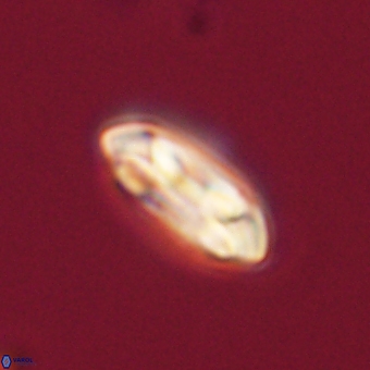Coccolithus gracejacovidesiae 68506