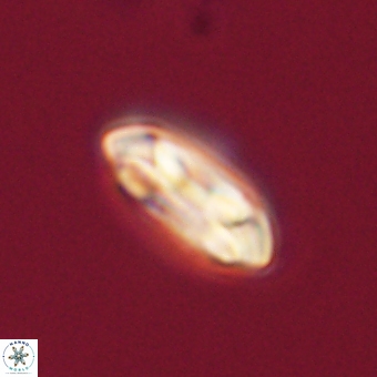 Coccolithus gracejacovidesiae 68506