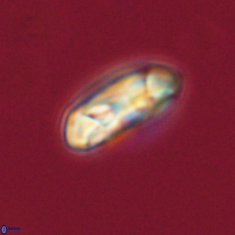 Coccolithus gracejacovidesiae 68510
