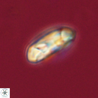 Coccolithus gracejacovidesiae 68510