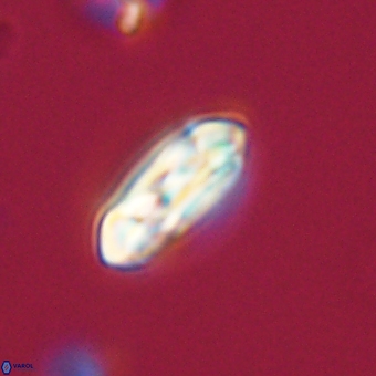 Coccolithus gracejacovidesiae 68720