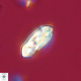 Coccolithus gracejacovidesiae 68720