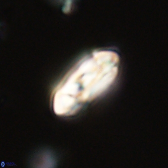 Coccolithus gracejacovidesiae 68721