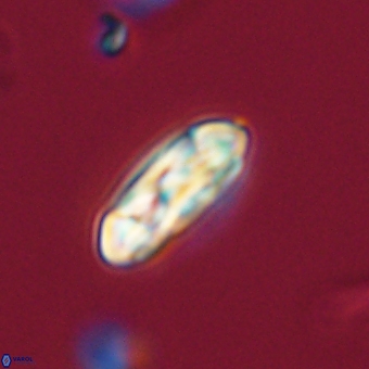 Coccolithus gracejacovidesiae 68723