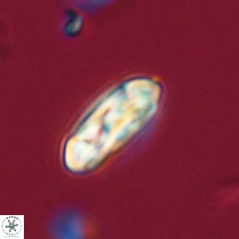 Coccolithus gracejacovidesiae 68723