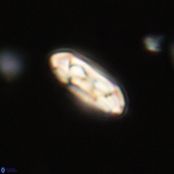 Coccolithus gracejacovidesiae 68725