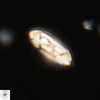 Coccolithus gracejacovidesiae 68725