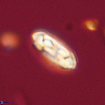 Coccolithus gracejacovidesiae 68726