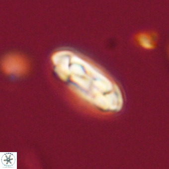Coccolithus gracejacovidesiae 68726