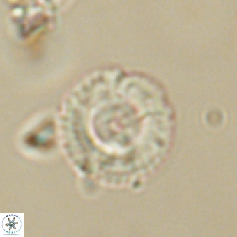 Coccolithus gracejacovidesiae 68735