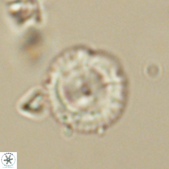 Coccolithus gracejacovidesiae 68736