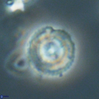 Coccolithus gracejacovidesiae 68737