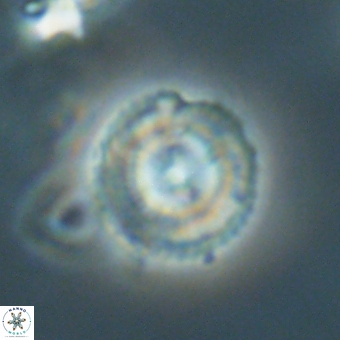 Coccolithus gracejacovidesiae 68737