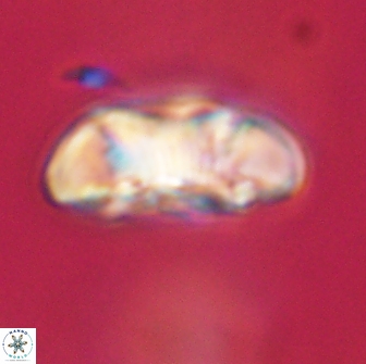 Coccolithus megasarsiae 64763