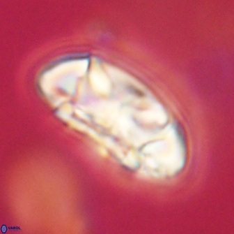 Coccolithus megasarsiae 64765