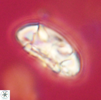 Coccolithus megasarsiae 64765