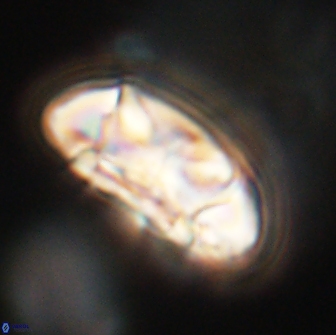 Coccolithus megasarsiae 64766