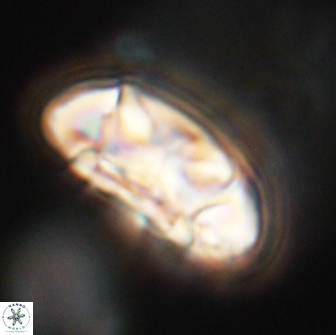 Coccolithus megasarsiae 64766