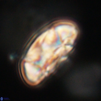 Coccolithus megasarsiae 64767