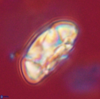 Coccolithus megasarsiae 64768