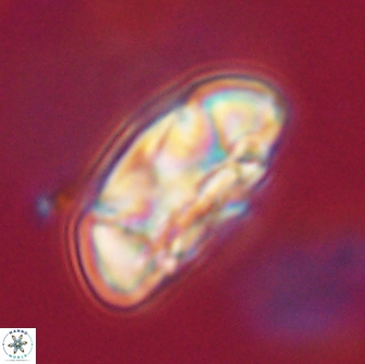 Coccolithus megasarsiae 64768