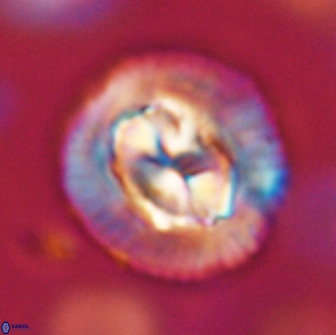 Coccolithus megasarsiae 64776