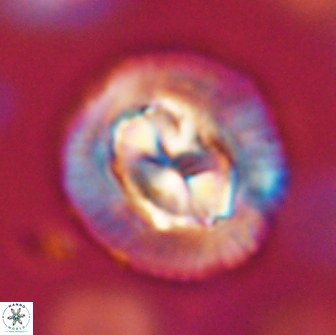 Coccolithus megasarsiae 64776