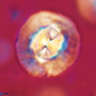 Coccolithus megasarsiae 64780
