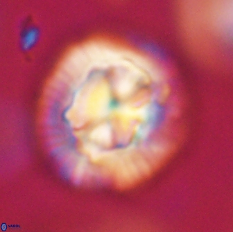 Coccolithus megasarsiae 64781