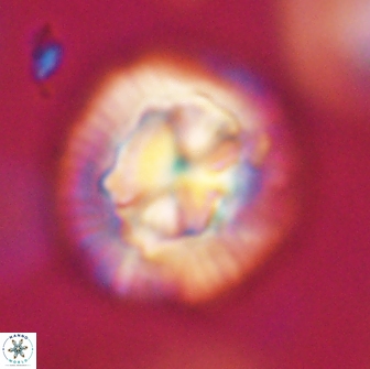 Coccolithus megasarsiae 64781
