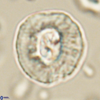 Coccolithus megasarsiae 64783