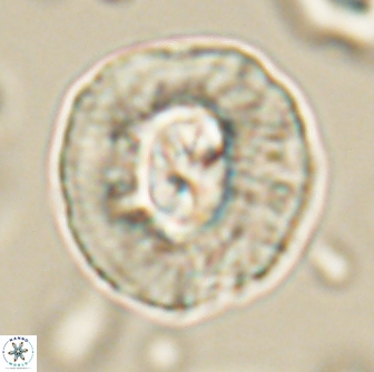Coccolithus megasarsiae 64783