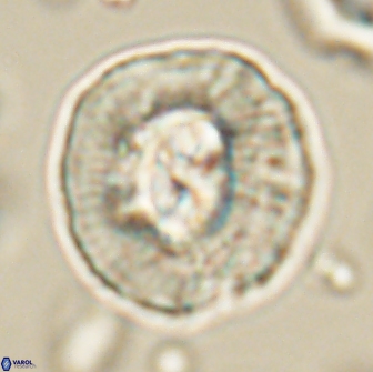Coccolithus megasarsiae 64784