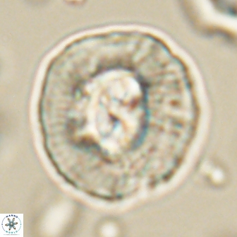 Coccolithus megasarsiae 64784