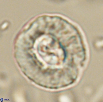 Coccolithus megasarsiae 64785