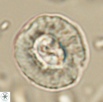 Coccolithus megasarsiae 64785